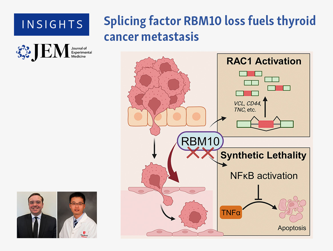 Journal of Experimental Medicine (@jexpmed) on Twitter photo Splicing factor RBM10 loss fuels #ThyroidCancer #metastasis. Kevin Coughlin and Ledong Wan <a href="/LedongW/">Ledong Wan</a> <a href="/stonybrooku/">Stony Brook University</a>
discuss study by <a href="/Gnana_Krish/">Gnana Krishnamoorthy</a> and colleagues (hubs.la/Q037-xzn0) in Insights: hubs.la/Q037-QFH0 Splicing factor RBM10 loss fuels #ThyroidCancer #metastasis. Kevin Coughlin and Ledong Wan <a href="/LedongW/">Ledong Wan</a> <a href="/stonybrooku/">Stony Brook University</a>
discuss study by <a href="/Gnana_Krish/">Gnana Krishnamoorthy</a> and colleagues (hubs.la/Q037-xzn0) in Insights: hubs.la/Q037-QFH0