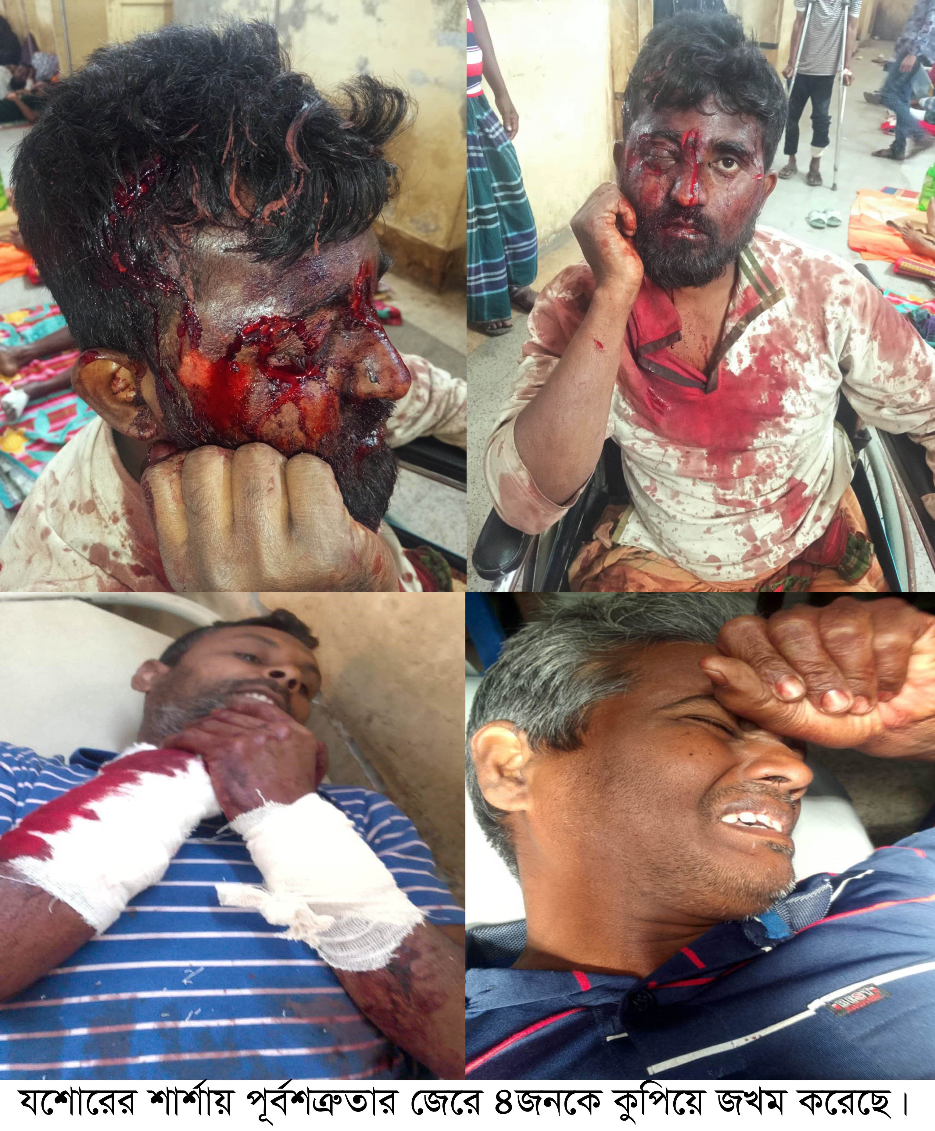 শার্শায় পূর্বশত্রুতার জেরে ৪ জনকে কুপিয়ে জখম