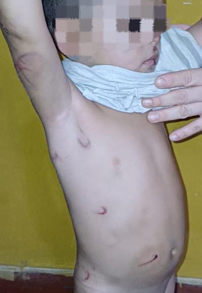 J. Augusto. Saldívar.📍

Brutal golpiza a niño de 3 años 
El autor sería el padrastro del menor. También golpeó a su pareja, madre del niño.
