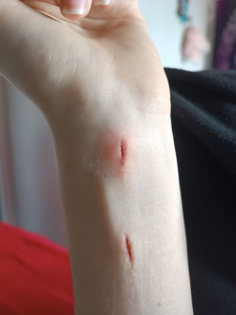 Ellie_shtwt's tweet photo. Anyone know what's going on? It's really swollen and far more painful than it should be https://t.co/HGvXI77Yzi