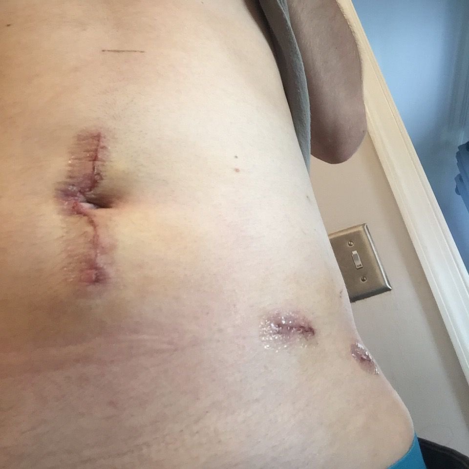 shinynfte_eth's tweet image. Ok. Sold my kidney to buy this dip. #smartmove #bigbrains