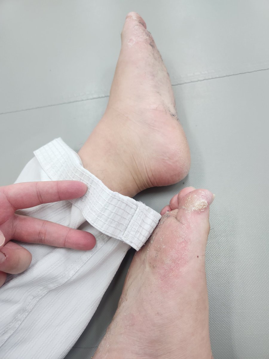 발차기를 많이하면 엄지에 굳은살이 생긴다는사실을 아시나요