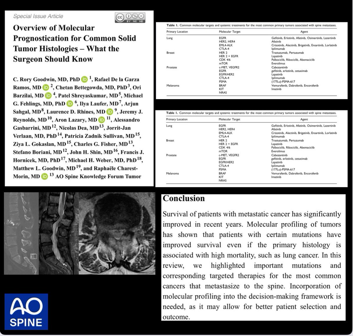 One of the most
challenging aspects of spinal oncology is properly scaling our intervention to the patient’s prognosis.

Latest work from the <a href="/AOSpine/">AO Spine</a> Tumor KF underscores the contribution of molecular profiling to our decision-making framework.

journals.sagepub.com/doi/epub/10.11…