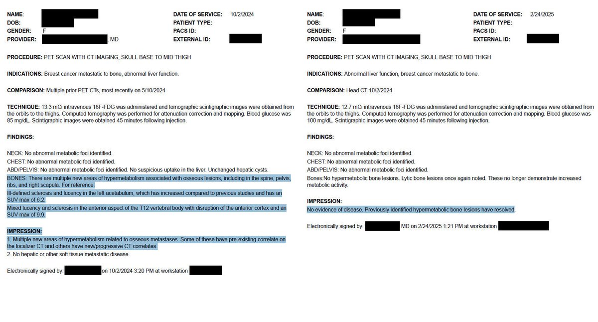NEW ARTICLE: IVERMECTIN and MEBENDAZOLE Testimonial - 46 year old Stage 4 Breast Cancer patient clears bone metastases in 3 months!! Confirmed on PET/CT!

This one comes with PROOF.

46 year old Stage 4 Breast Cancer patient (USA) with progressive bone metastases had increasing