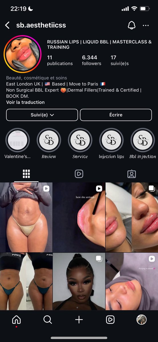 KEEYGHT's tweet photo. j’incite pas aux injections, mais je sais que certaines préfèrent aller chez les filles d’Insta (same)
Faites attention à elle : elle prend les acomptes, puis bloque les clientes et ne répond plus. Elle prétend être dans le 18e, mais c’est faux, elle usurpe l’identité d'une UK https://t.co/WlXQnXdDq4