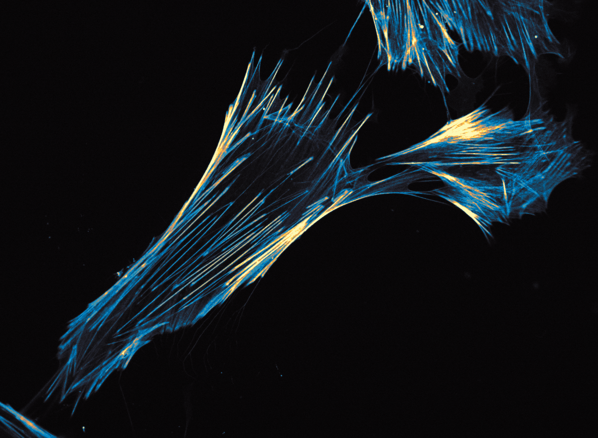 Spirochrome (@spirochrome) on Twitter photo 📢New product launch:
SPY555-FastAct_X:
✅ Improved actin ligand captures very fast actin dynamics
✅ No toxicity
✅ High brightness
✅ Low phototoxicity
✅ High photoblueing & bleaching resistance
spirochrome.com/product/spy555…
Image credits: <a href="/LindaWedemann/">Linda Wedemann</a> from <a href="/MMSchuhmacher/">Milena Schuhmacher</a> lab 📢New product launch:
SPY555-FastAct_X:
✅ Improved actin ligand captures very fast actin dynamics
✅ No toxicity
✅ High brightness
✅ Low phototoxicity
✅ High photoblueing & bleaching resistance
spirochrome.com/product/spy555…
Image credits: <a href="/LindaWedemann/">Linda Wedemann</a> from <a href="/MMSchuhmacher/">Milena Schuhmacher</a> lab