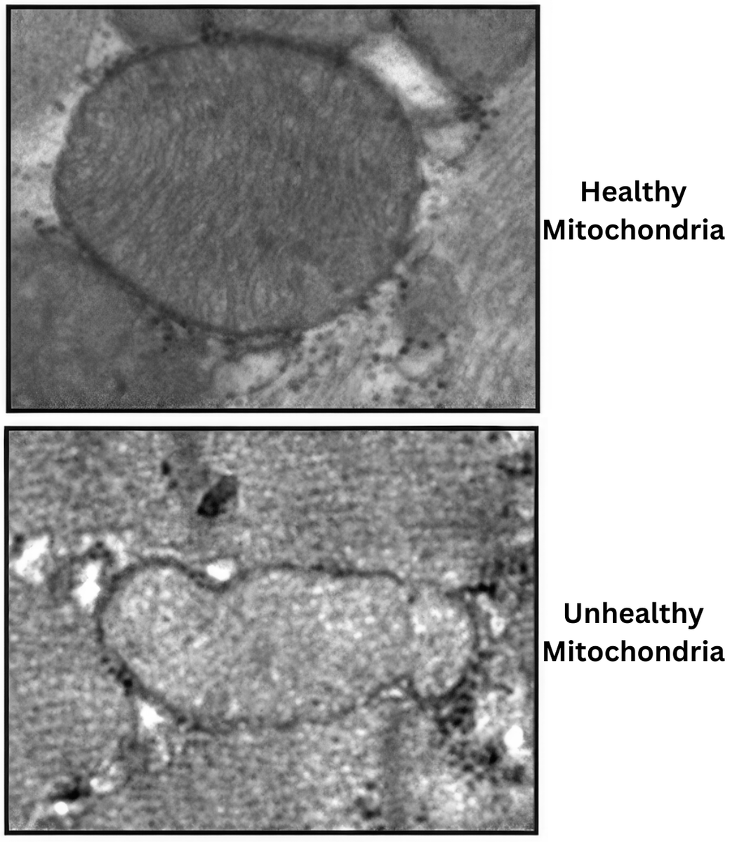 If you need caffeine just to feel normal, your energy is broken.

Here’s what’s really draining you—and how to fix it (for good):