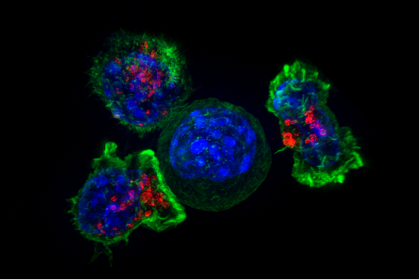 NCI-supported researchers have developed a method of reviving exhausted T cells to fight
cancer. Read about the study: go.nih.gov/h2cazBS <a href="/PittTweet/">University of Pittsburgh</a> <a href="/UPMCHillmanCC/">UPMC Hillman Cancer Center</a> #Tcells