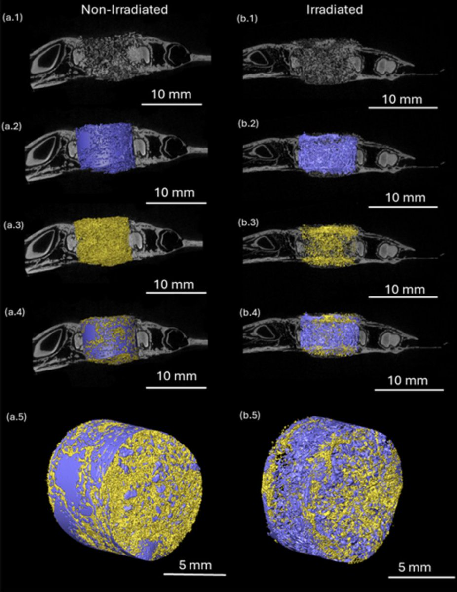 Simon Young (@siwyoung) on Twitter photo Bone regeneration in compromised wounds is tough! We continue our collaboration with <a href="/PauloGCoelho1/">Paulo G. Coelho</a> <a href="/LukaszWitekPhD/">Lukasz Witek, PhD</a> and Kurt Kasper, developing a challenging preclinical model of ORN to test bone grafting strategies. tinyurl.com/jxr9j7sc Bone regeneration in compromised wounds is tough! We continue our collaboration with <a href="/PauloGCoelho1/">Paulo G. Coelho</a> <a href="/LukaszWitekPhD/">Lukasz Witek, PhD</a> and Kurt Kasper, developing a challenging preclinical model of ORN to test bone grafting strategies. tinyurl.com/jxr9j7sc