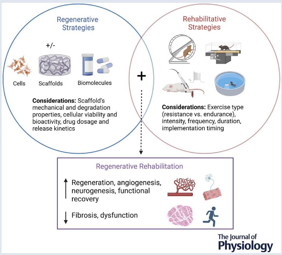 johnny owens (@johnnyowenscfi) on Twitter photo There is a lot of excitement around regenerative medicine in Orthopaedics and Rehab, but a big gap between pre-clinical promise and clinical implementation. Our most recent paper discussing the topic:
physoc.onlinelibrary.wiley.com/doi/pdf/10.111…
<a href="/Owens_Recovery/">Owens Recovery</a> There is a lot of excitement around regenerative medicine in Orthopaedics and Rehab, but a big gap between pre-clinical promise and clinical implementation. Our most recent paper discussing the topic:
physoc.onlinelibrary.wiley.com/doi/pdf/10.111…
<a href="/Owens_Recovery/">Owens Recovery</a>