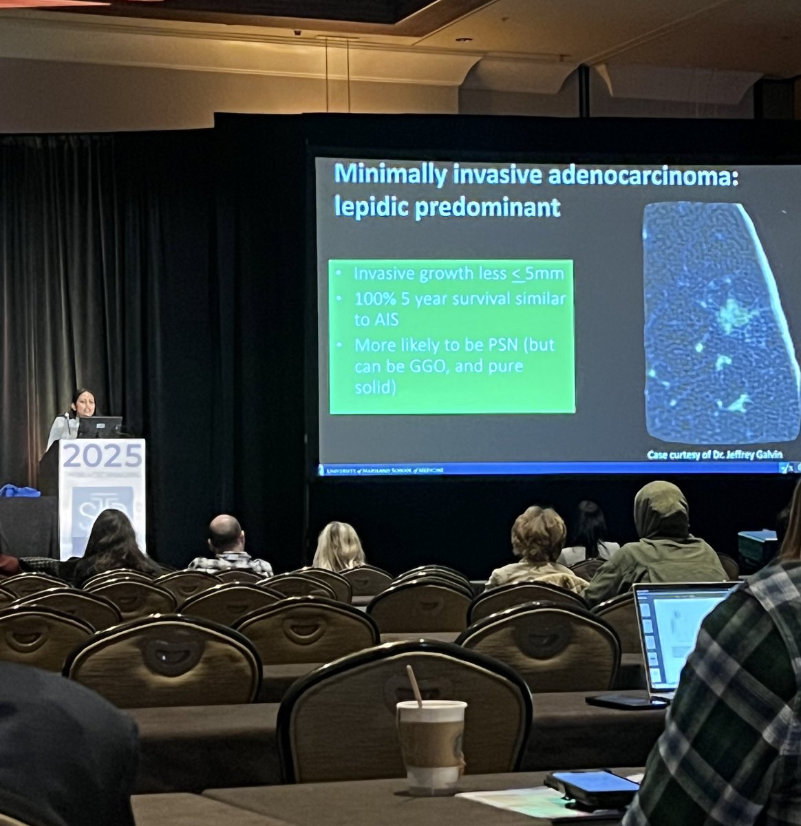 Daniel Vargas, MD (@danielvargasmd) on Twitter photo Reviewing challenging Lung-RADS cases w <a href="/RydhwanaH_MD/">Rydhwana Hossain MD</a> #STR2025 <a href="/thoracicrad/">Society of Thoracic Radiology</a> Reviewing challenging Lung-RADS cases w <a href="/RydhwanaH_MD/">Rydhwana Hossain MD</a> #STR2025 <a href="/thoracicrad/">Society of Thoracic Radiology</a>