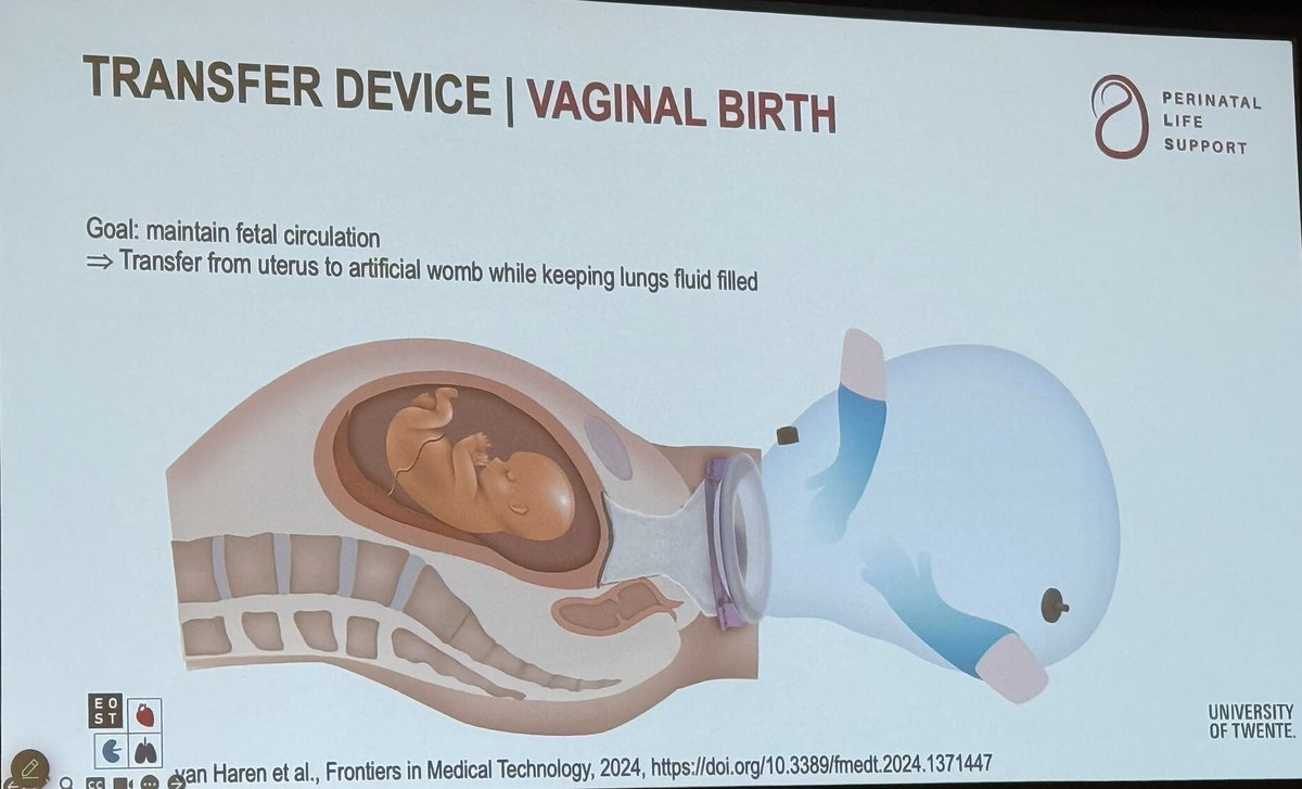 The future is closer than you think! 
A fascinating update by Jutta Arens at the #ECMO meeting.
#ArtificialWomb
#ArtificialPlacenta