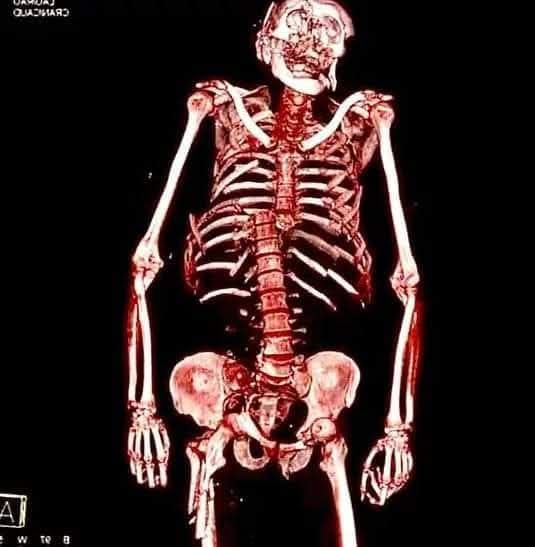 La importancia de respetar el límite de velocidad cuando manejas moto.