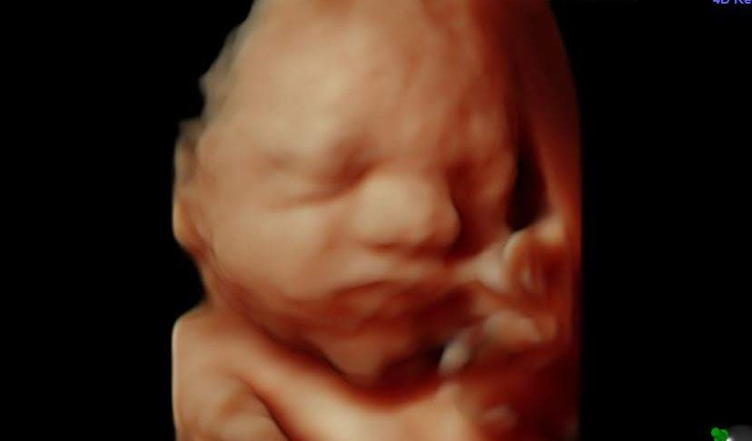 LifeNewsHQ's tweet image. Do Aborted and Miscarried Babies Go to Heaven? buff.ly/doB7pib