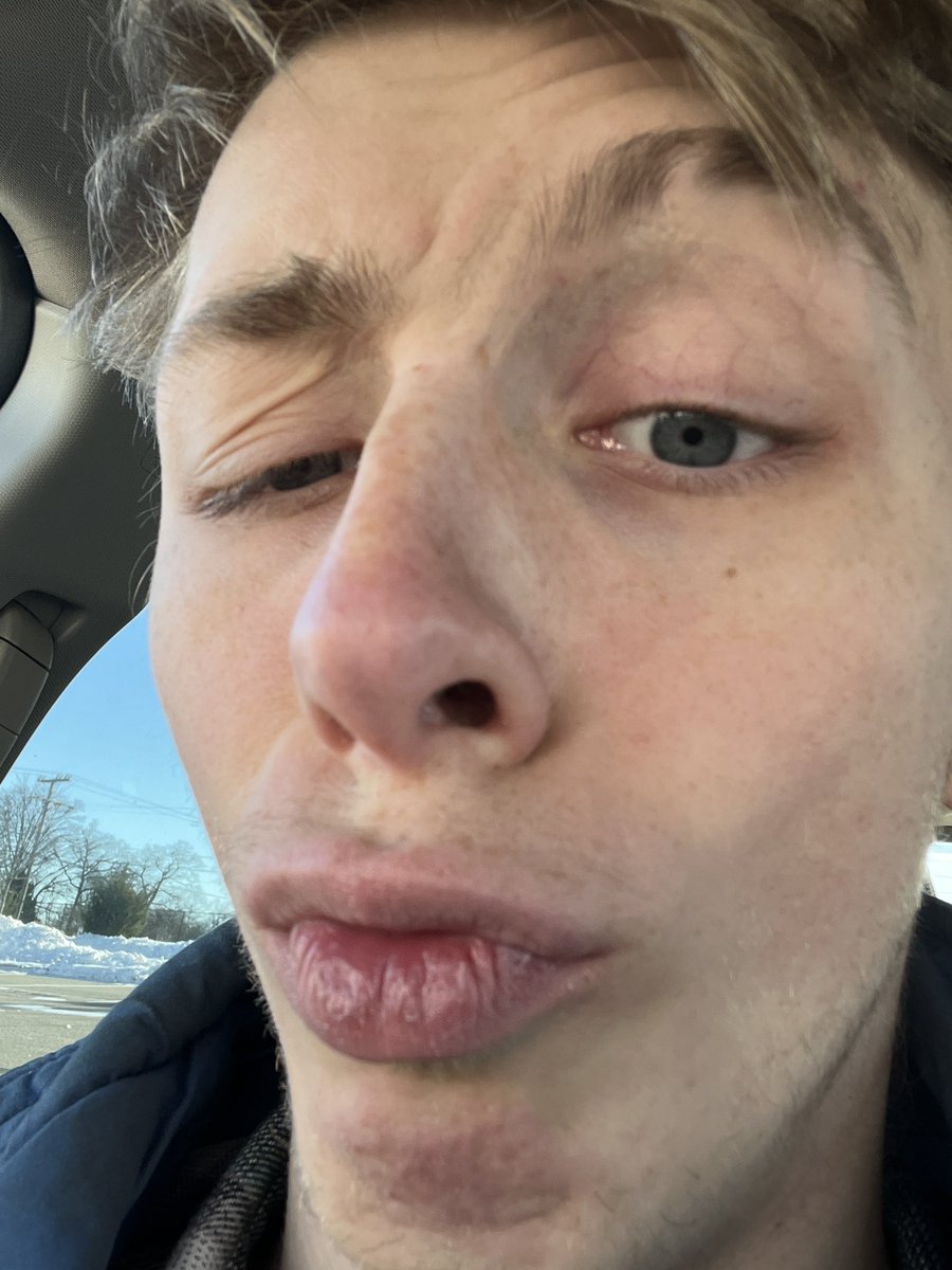 Icee tweet media