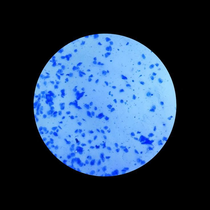 HunterEsoteric's tweet photo. The Ultimate Guide to Methylene Blue

One of the strongest longevity tool on the planet 

- How Methylene Blue changed my life
- Exactly why it works miracles
- How to use it 

THREAD 🧵 https://t.co/VAKmuxQRgj