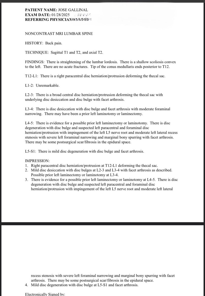 joeygallinal's tweet image. Let’s compare backs! 
Where my #backproblem people at??