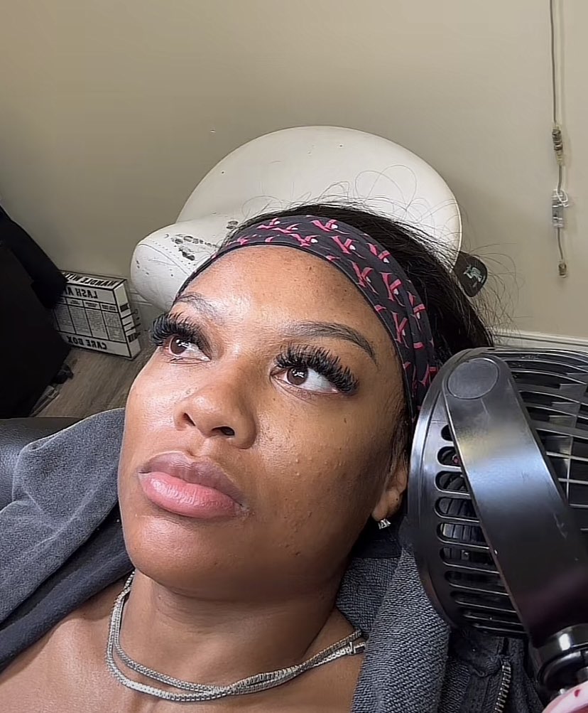 LoveYouForLife7's tweet photo. Her face ain’t the only place with bumps 🤣🤮🤢 Netta Jr https://t.co/Pyly4OLM95