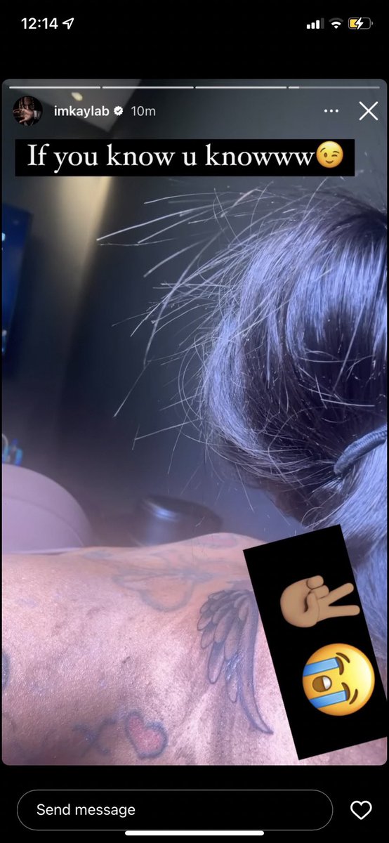 LoveYouForLife7's tweet photo. Her face ain’t the only place with bumps 🤣🤮🤢 Netta Jr https://t.co/Pyly4OLM95