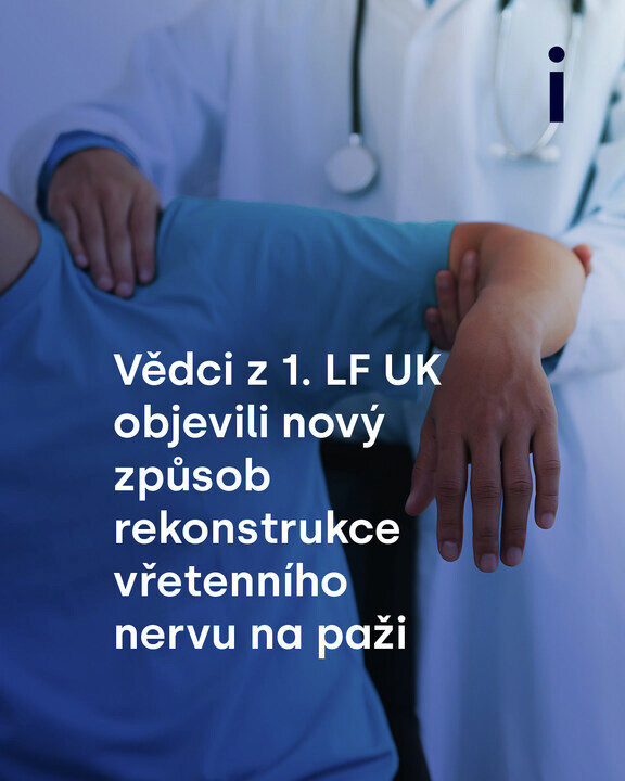 👏 Vědci z 1. LF UK dosáhli významného posunu v oblasti rekonstrukce nervů na paži. Tento objev má potenciál zásadně ovlivnit klinickou praxi a zlepšit výsledky léčby. 
ℹ️ Čtěte na <a href="/iDNEScz/">iDNES.cz</a>: kont.ly/349bf6ed