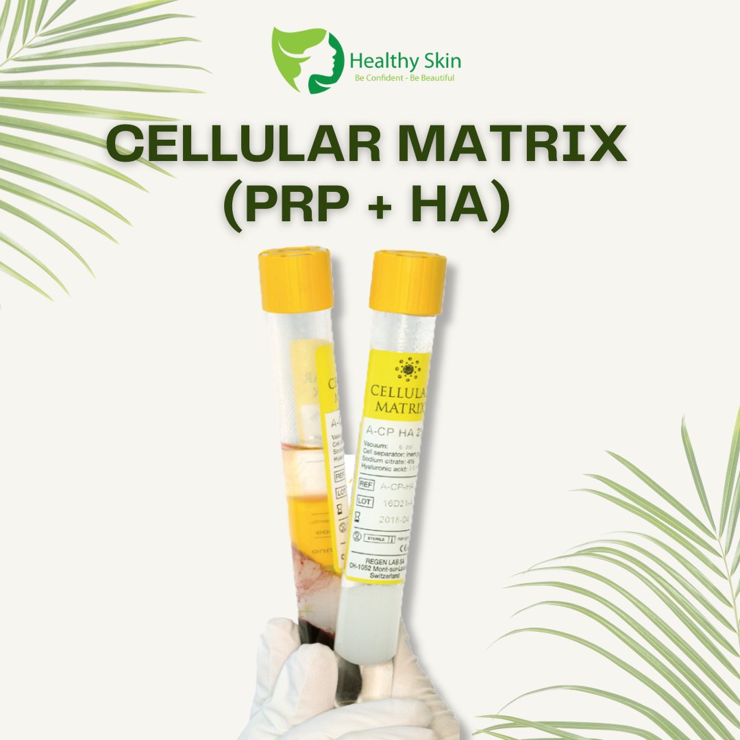 HealthySkinHKT's tweet image. Unlock your skin&apos;s true potential with our 𝗖𝗲𝗹𝗹𝘂𝗹𝗮𝗿 𝗠𝗮𝘁𝗿𝗶𝘅 𝗡𝗮𝘁𝘂𝗿𝗮𝗹 𝗛𝗔 𝗘𝗻𝗿𝗶𝗰𝗵𝗲𝗱 𝗯𝘆 𝗬𝗼𝘂𝗿 𝗣𝗹𝗮𝘁𝗲𝗹𝗲𝘁𝘀’ 𝗚𝗿𝗼𝘄𝘁𝗵 𝗙𝗮𝗰𝘁𝗼𝗿𝘀. 🧬✨

📞 𝗕𝗼𝗼𝗸 𝘆𝗼𝘂𝗿 𝗰𝗼𝗻𝘀𝘂𝗹𝘁𝗮𝘁𝗶𝗼𝗻 𝘁𝗼𝗱𝗮𝘆!

#CellularMatrix #PRP #Phuket #Thailand