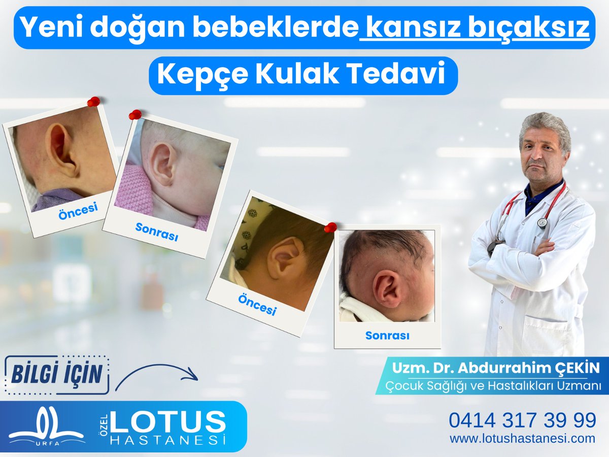 AkinCiftkus's tweet photo. @lotushastanesi 
@bulentazizz 
@abdurrahimcekin https://t.co/zj6DGPdP9T