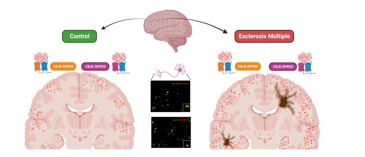 🧠🔬 Investigadoras de @INEUROPA_UniOvi han identificado, por primera vez, heterómeros de receptores cannabinoides CB₁R-GPR55 y CB₂R-GPR55 en la corteza prefrontal humana de pacientes con esclerosis múltiple.

🔗📖 pmc.ncbi.nlm.nih.gov/articles/PMC11…

#Neurociencia #EsclerosisMúltiple
