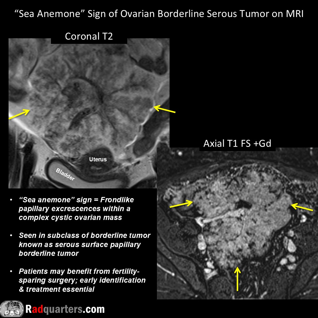 Radquarters's tweet image. #FOAMrad #FOAMed #radres #radtech #medstudent #radquarters