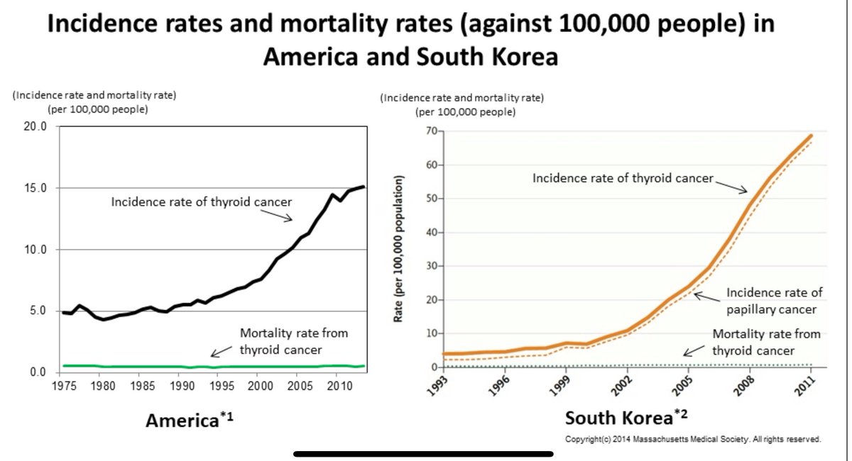 Wil (@willyrontgen) on Twitter photo Can <a href="/DOGE/">Department of Government Efficiency</a> look into Thyroid US exams? I propose eliminating all thyroid US exams. No more follow ups until death for benign nodules while inducing patient anxiety. No more unnecessary biopsies. No more overdiagnosis of cancers with no effect on mortality. <a href="/VPrasadMDMPH/">Vinay Prasad MD MPH</a> <a href="/elonmusk/">Elon Musk</a> Can <a href="/DOGE/">Department of Government Efficiency</a> look into Thyroid US exams? I propose eliminating all thyroid US exams. No more follow ups until death for benign nodules while inducing patient anxiety. No more unnecessary biopsies. No more overdiagnosis of cancers with no effect on mortality. <a href="/VPrasadMDMPH/">Vinay Prasad MD MPH</a> <a href="/elonmusk/">Elon Musk</a>