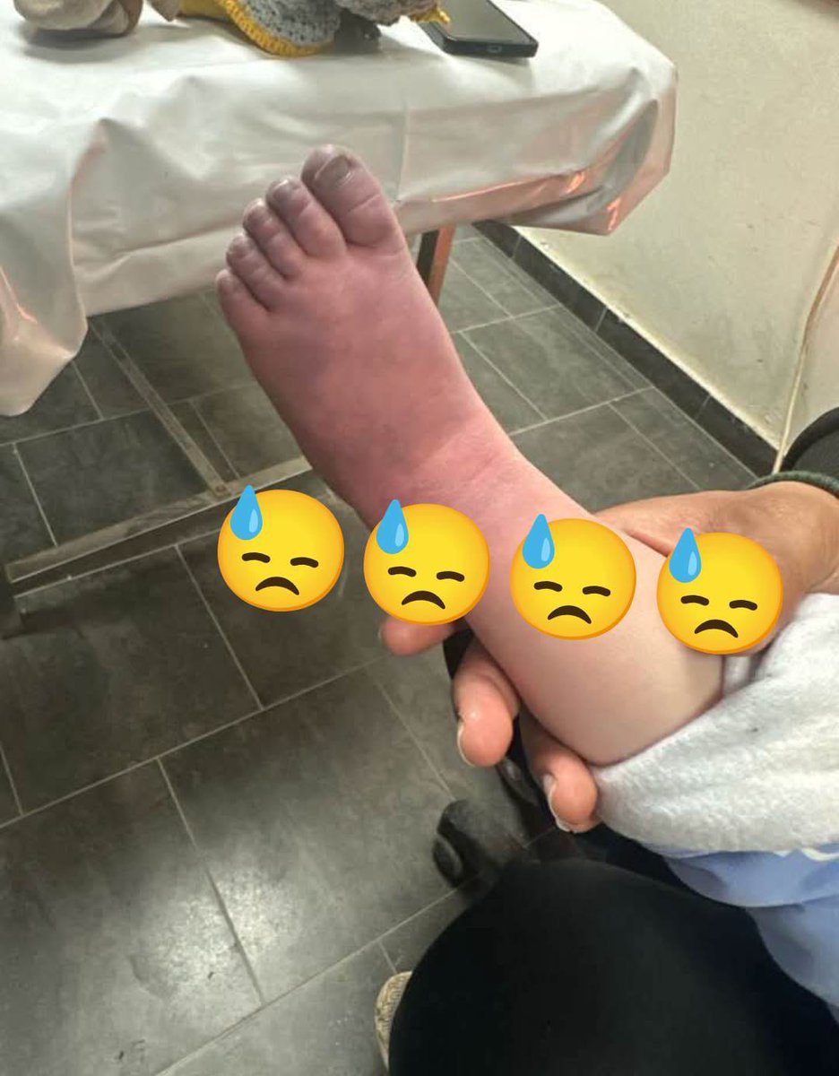 HE WILL DIE

It is very cold in the tents, MY BROTHER'S FEET HAVE turned blue, he is shivering from the cold and feeling hungry, I am very afraid that my brother will lose his feet from the cold, PLEASE HELP us by providing some clothes and heavy blankets.
gofund.me/56ac07a6