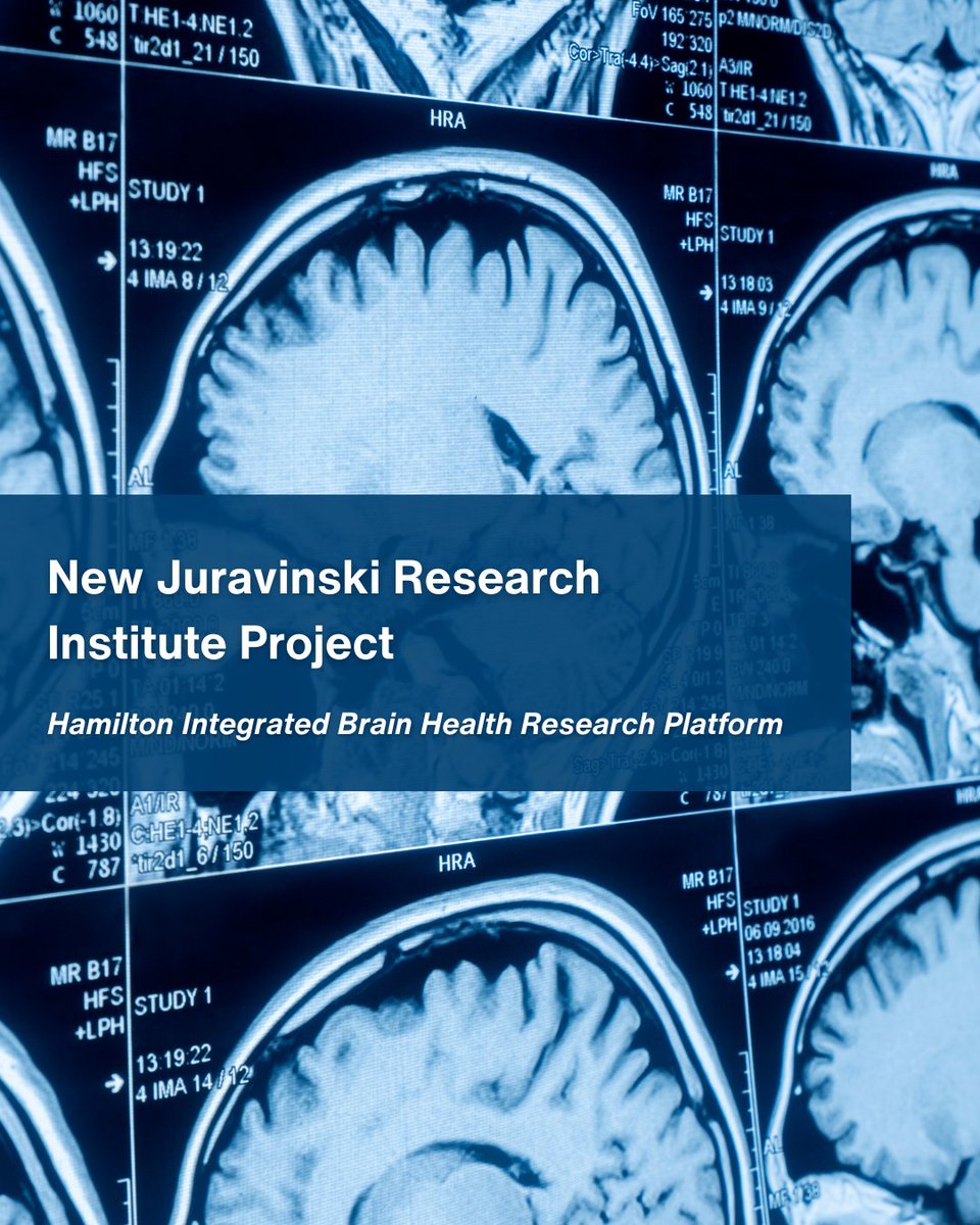 St. Joe's Healthcare (Hospital & Foundation) (@stjoeshamilton) on Twitter photo Thanks to the #JuravinskiLegacy, researchers at <a href="/HamHealthSci/">Hamilton Health Sciences</a>, <a href="/McMasterU/">McMaster University</a> and @STJOESHAMILTON are charting a course to make Hamilton an international leader in brain health research.
Learn more ➡️ bit.ly/4il62a3
<a href="/JustinLeeMD/">Justin Lee</a>
<a href="/DrMikeNose/">Michael Noseworthy</a>
<a href="/machealthsci/">McMaster Health Sciences</a>
<a href="/ResearchStJoes/">The Research Institute of St. Joe's Hamilton</a> Thanks to the #JuravinskiLegacy, researchers at <a href="/HamHealthSci/">Hamilton Health Sciences</a>, <a href="/McMasterU/">McMaster University</a> and @STJOESHAMILTON are charting a course to make Hamilton an international leader in brain health research.
Learn more ➡️ bit.ly/4il62a3
<a href="/JustinLeeMD/">Justin Lee</a>
<a href="/DrMikeNose/">Michael Noseworthy</a>
<a href="/machealthsci/">McMaster Health Sciences</a>
<a href="/ResearchStJoes/">The Research Institute of St. Joe's Hamilton</a>