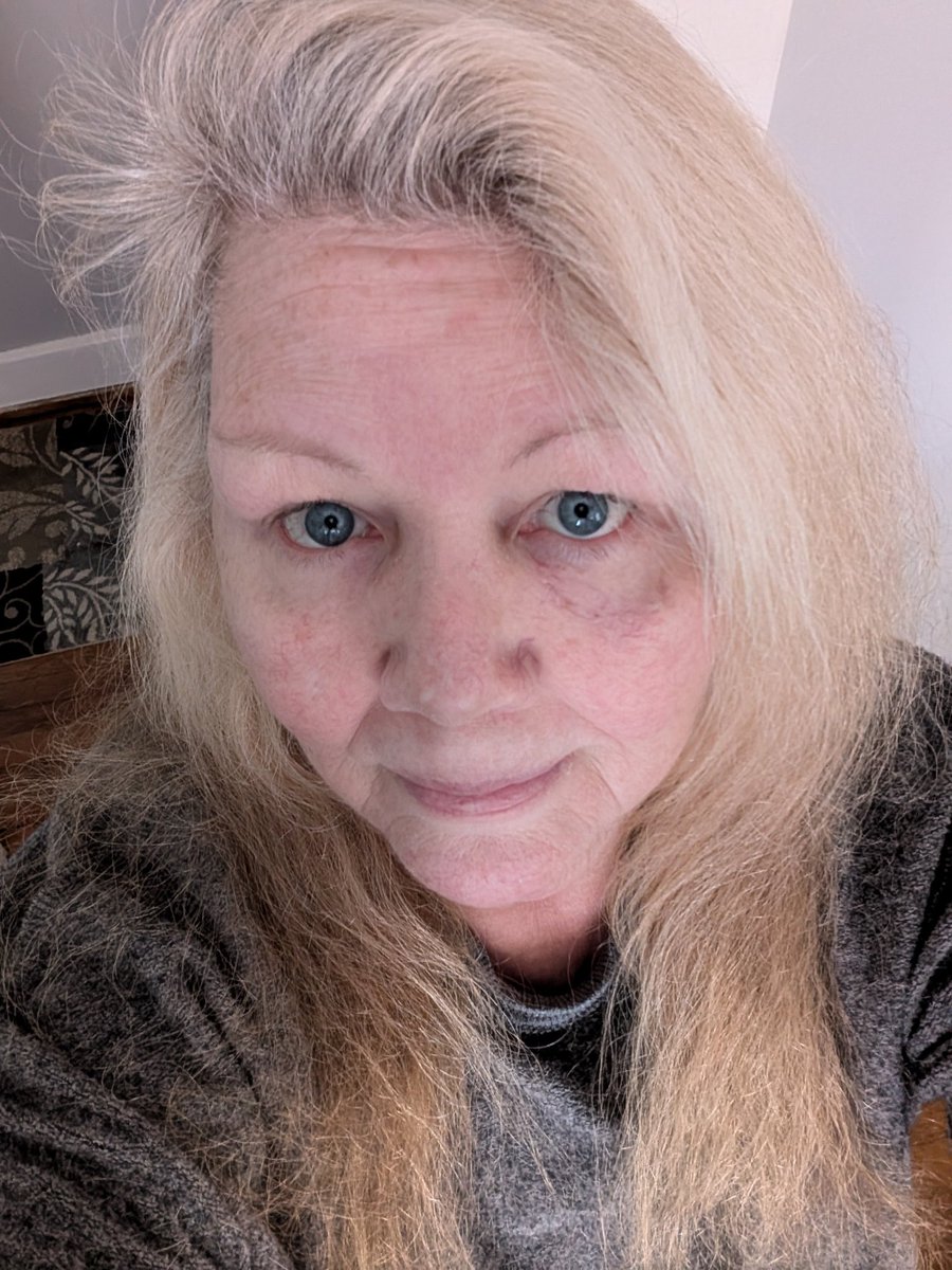 I'm here guys, ignore this head and the inside out shirt . Dang yesterday was a day but I got all my stuffs done.. 👍