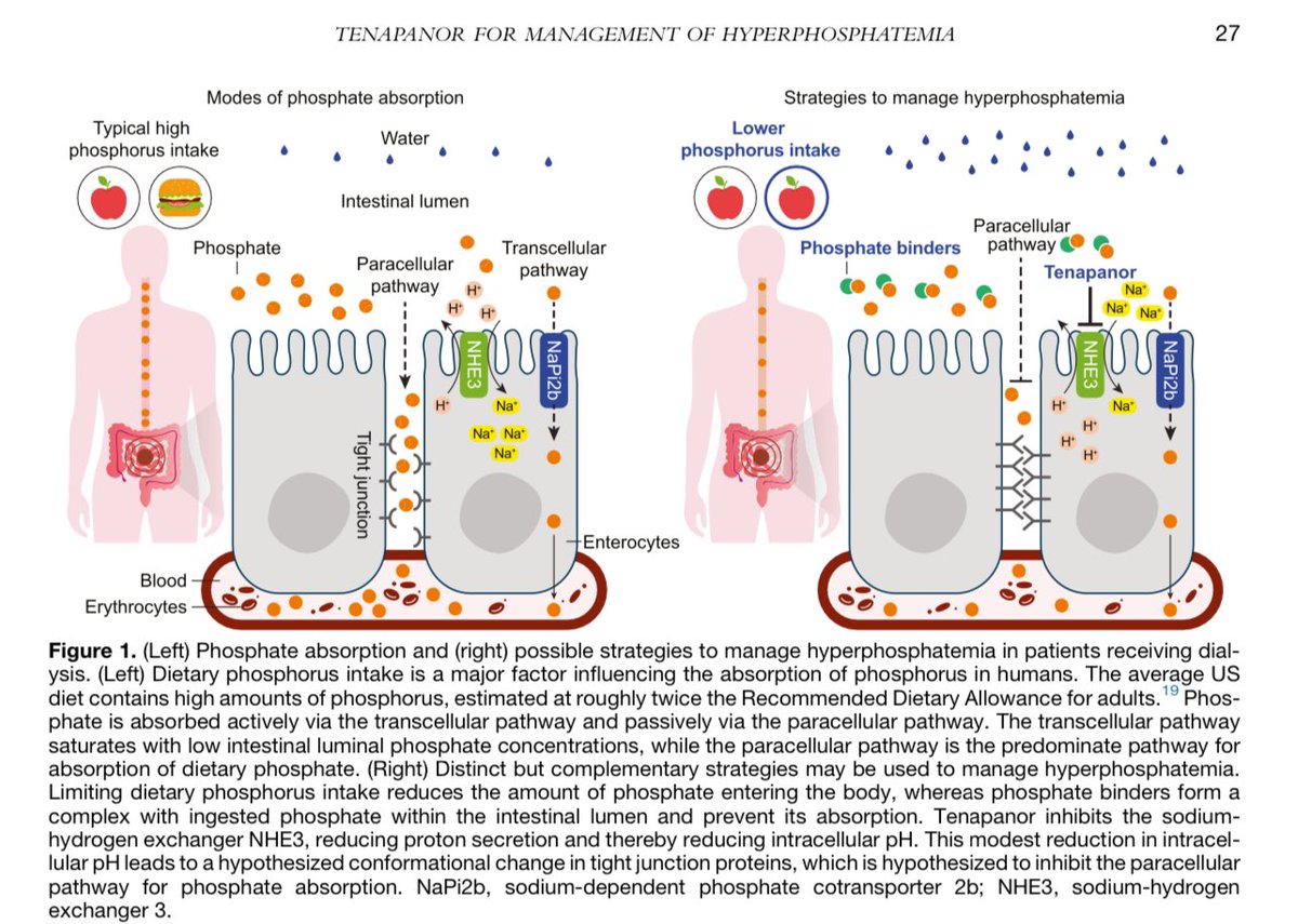 hardik4u24's tweet photo. Struggling with hyperphosphatemia in dialysis patients? 🦴🫘
Meet #Tenapanor!
It inhibits paracellular phosphate absorption by modulating NHE3 & tight junctions.
A novel way to tackle phosphorus! 🔬💊
#Nephrology #Hyperphosphatemia #Dialysis #HD
📖https://t.co/TBdwHnMygG https://t.co/u3scJI6YXQ