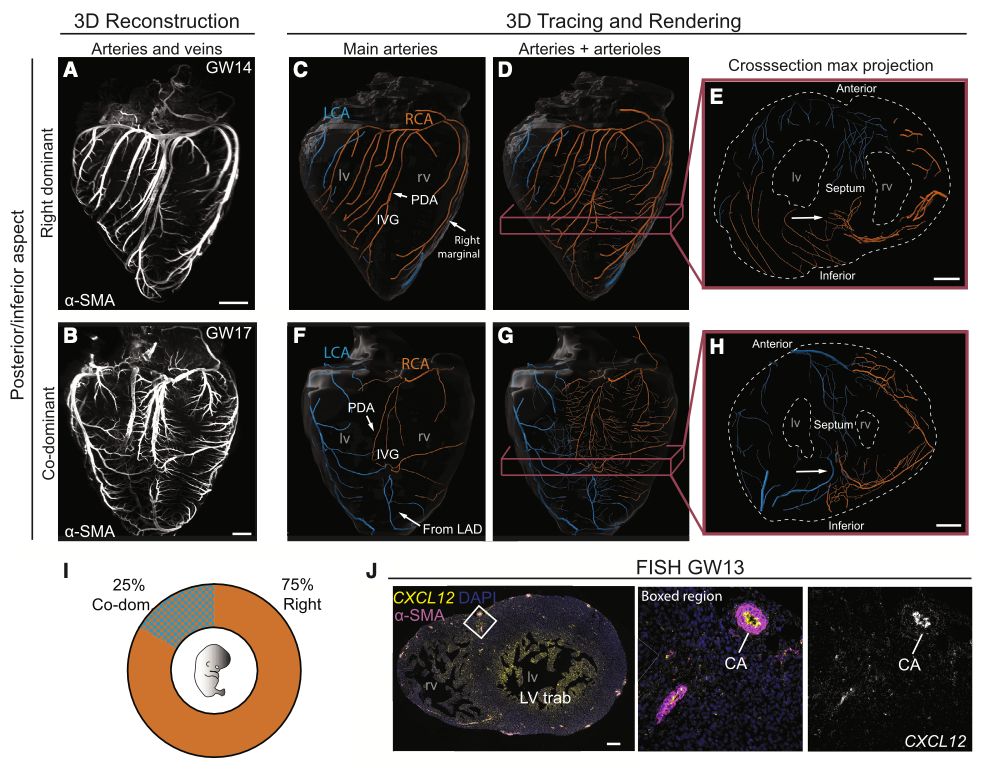 PamR33's tweet image. "Among all the uncertainty, you can always count on awesome science to make you smile. Check out our latest @CellCellPress interdisciplinary endeavor—a reminder that we all have a 🫀, whether right-dominant or not! sciencedirect.com/science/articl…