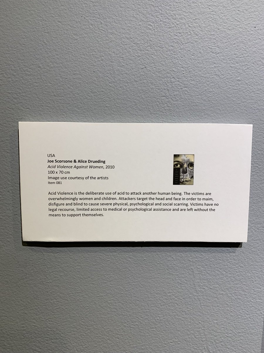 cppartgalleries's tweet image. “Acid Violence Against Women” (2010) by Joe Scorsone & Alice Drueding powerfully captures the devastating impact of acid attacks on women and children. This haunting piece exposes the physical, psychological, and social scars left behind. Come see it and witness a powerful call.