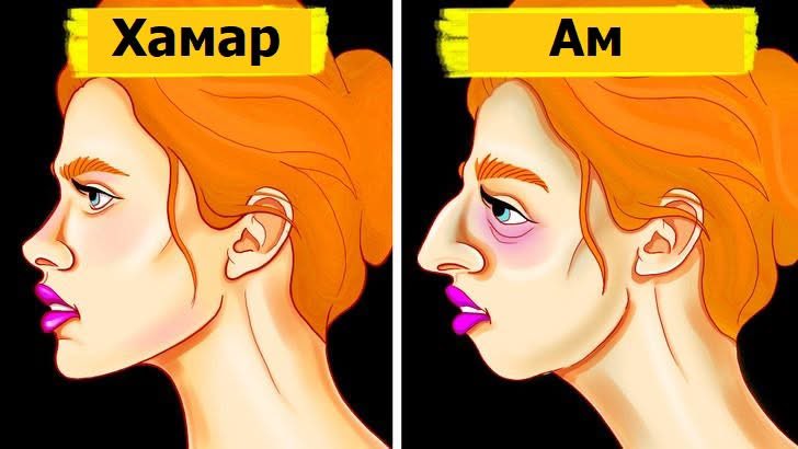 Насанд хүрэгчдийн 71% нь амаараа амьсгалдаг бөгөөд тэд ингэж байгаагаа ч мэддэггүй байна...

Муу тал нь юу гээч…
Тэд…
• Унтах…
• Эрч хүч…
• Тархины үйл ажиллагаагаа устгаж байгаагаа мэддэггүй…
Амаар амьсгалах талаар болон түүнийг хэрхэн зогсоох талаар хэдэн зөвлөгөө