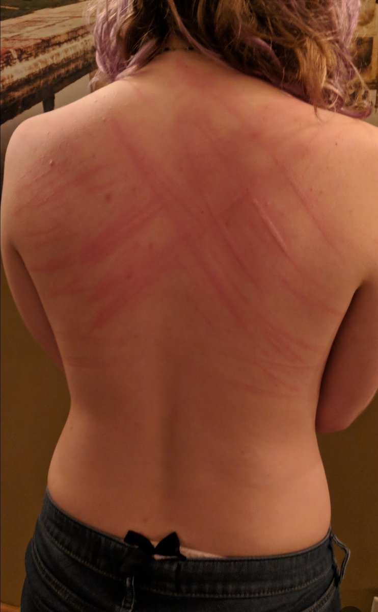 While a true spanko, i do occasionally enjoy leaving artistic marks on a willing back!