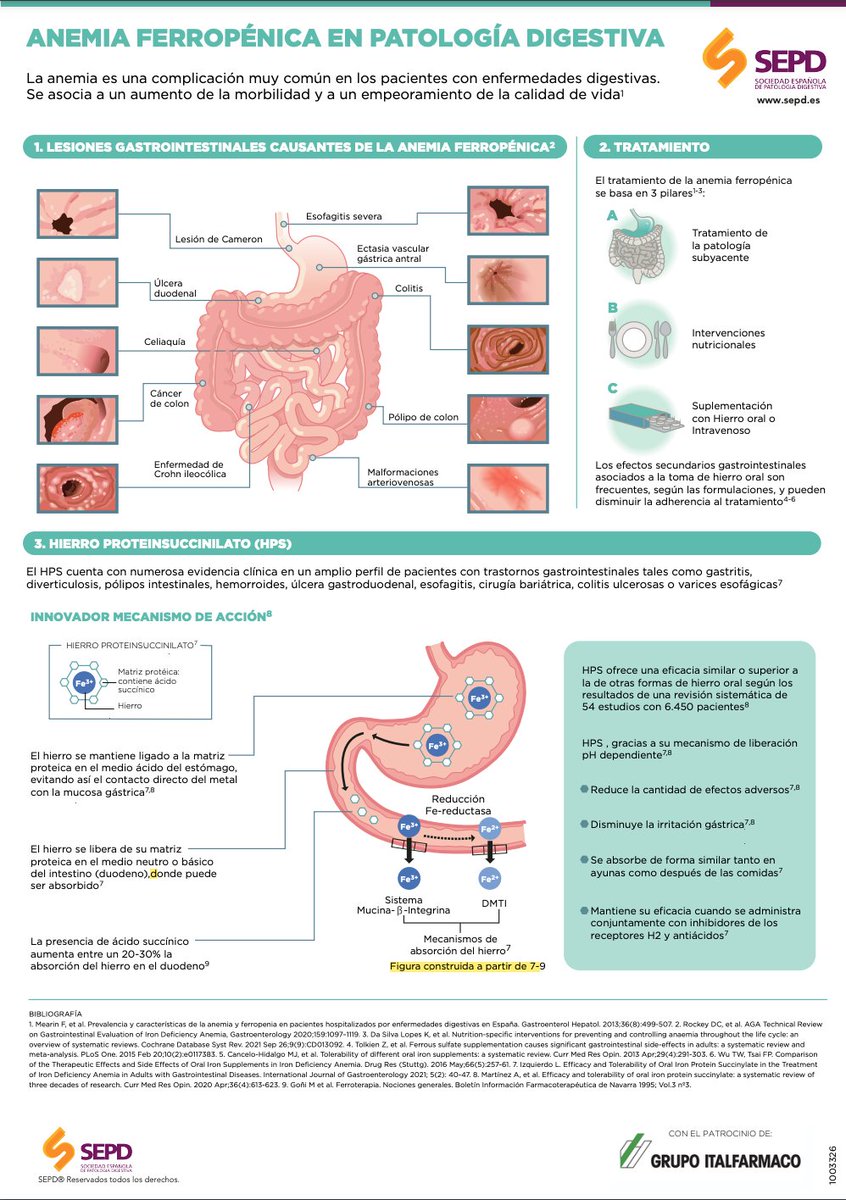 Anemia ferropénica, posibles causas de origen digestivo #Salud 👇¿Cuál es su tratamiento? #Infografía
<a href="/sepdigestiva/">Sociedad Española de Patología Digestiva (SEPD)</a> <a href="/saludigestivo/">Fundación Española del Aparato Digestivo (FEAD)</a>