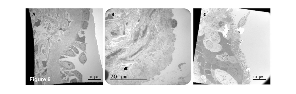 Open Access: The Direct and Indirect Role of IgE on Airway Epithelium in Asthma. First and corresponding author: Christian Domingo

Read the article here: doi.org/10.1111/all.16…

With over 5 figures and 120 references, this review article provides an overview of the effect of