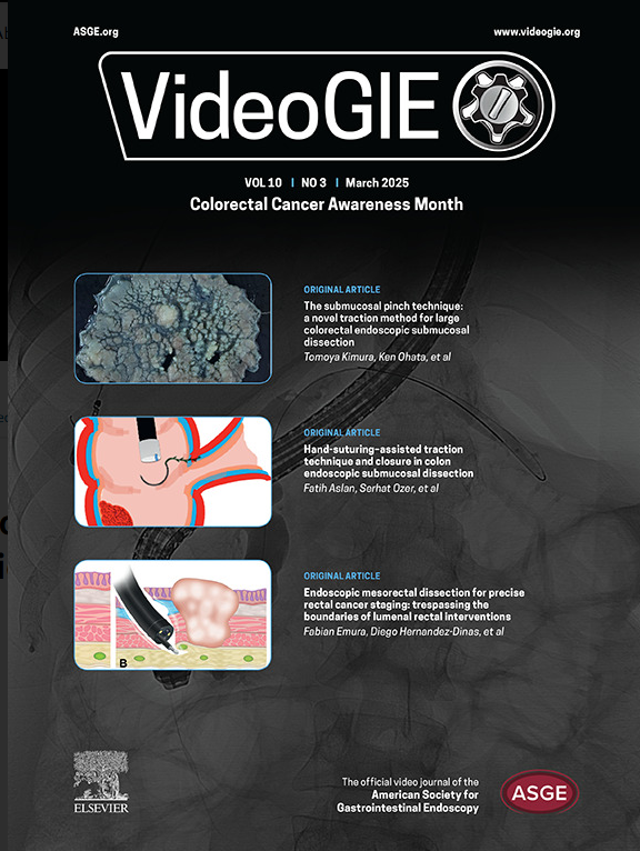 ASGEendoscopy's tweet photo. Mark #NationalColorectalCancerAwarenessMonth with VideoGIE’s March issue, featuring a curated collection of articles dedicated to issues related to screening. View now at https://t.co/U0norOBaOD. #NCRCAM #GITwitter https://t.co/55m7UTty5f