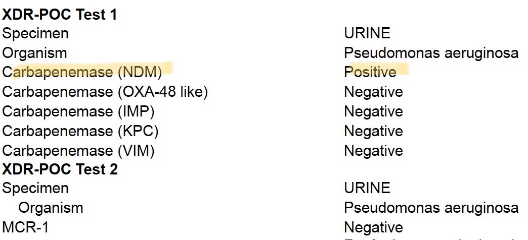 <a href="/CamsNepal/">CAMS Nepal</a> AMR MAPPING in #NEPAL
- too many NDMs, then OXA-48 !!
This is seriously alarming !!

The majority of the superbugs in ICUs of Kathmandu, Nepal, have NDM, which is very contrasting to the data from the US

We are in AMR Epidemic here !!