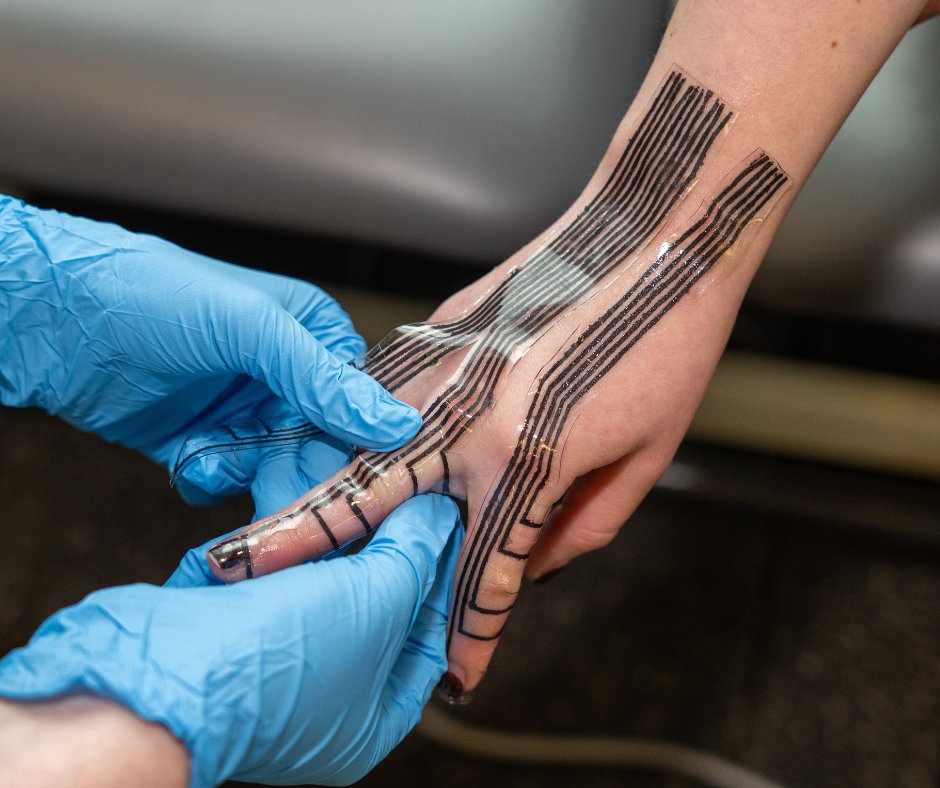 Penn Engineering (@pennengineers) on Twitter photo New, wearable sensors could revolutionize tendon rehab. Led by Flavia Vitale (<a href="/PennNeurology/">University of Pennsylvania Neurology</a>) & <a href="/joshrbaxter/">Josh Baxter</a>, researchers are using MXene-based sensors to advance recovery for injuries like Achilles tendinopathy.
bit.ly/4hh4NYu New, wearable sensors could revolutionize tendon rehab. Led by Flavia Vitale (<a href="/PennNeurology/">University of Pennsylvania Neurology</a>) & <a href="/joshrbaxter/">Josh Baxter</a>, researchers are using MXene-based sensors to advance recovery for injuries like Achilles tendinopathy.
bit.ly/4hh4NYu