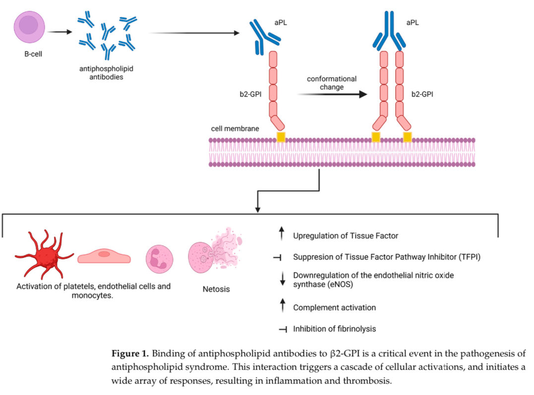 hardik4u24's tweet image. Antiphospholipid Syndrome (APS): The Silent Thrombophilia

From molecular pathogenesis to devastating thrombotic complications—#APS is a ticking time bomb! ⏳🧬

📖 APS review: doi.org/10.3390/jcm140… (2025) 

#Nephrology #Thrombosis #Lupus #MedTwitter  #Rheumatology #Autoimmune