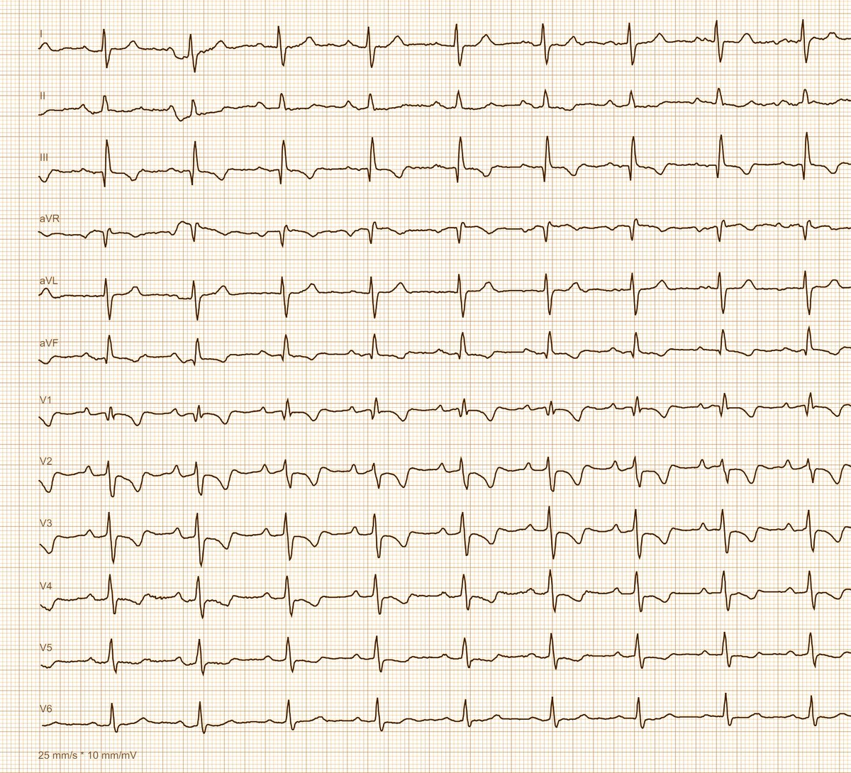 Dr. Andreas Roeschl tweet media
