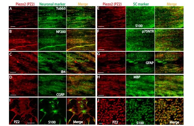Neuromics's tweet photo. #TBT Back in 2021, scientists from @MedicalCollege used our primary human Schwann cells (cat. HMP303) in a study. They looked into the function of Piezo2, a protein involved in touch and other functions.

Learn more: https://t.co/HrOnN7z8Pz

#neuroscience #Schwanncells #humancell https://t.co/Gfw8Cn2PuL