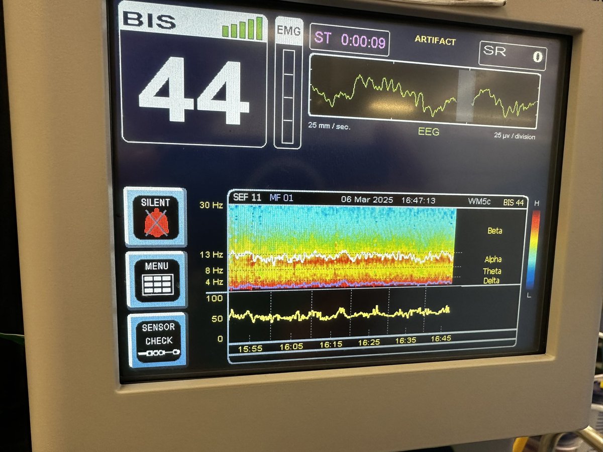 Fabulous spectrogram from an 84yo lady having a revision hip today.
#youngbrain