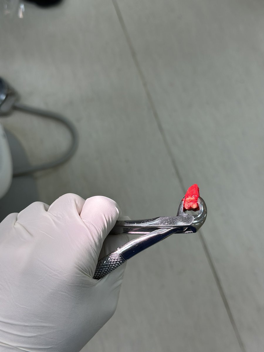 trigeminal_V's tweet image. Always watch the grip 🤝🏻