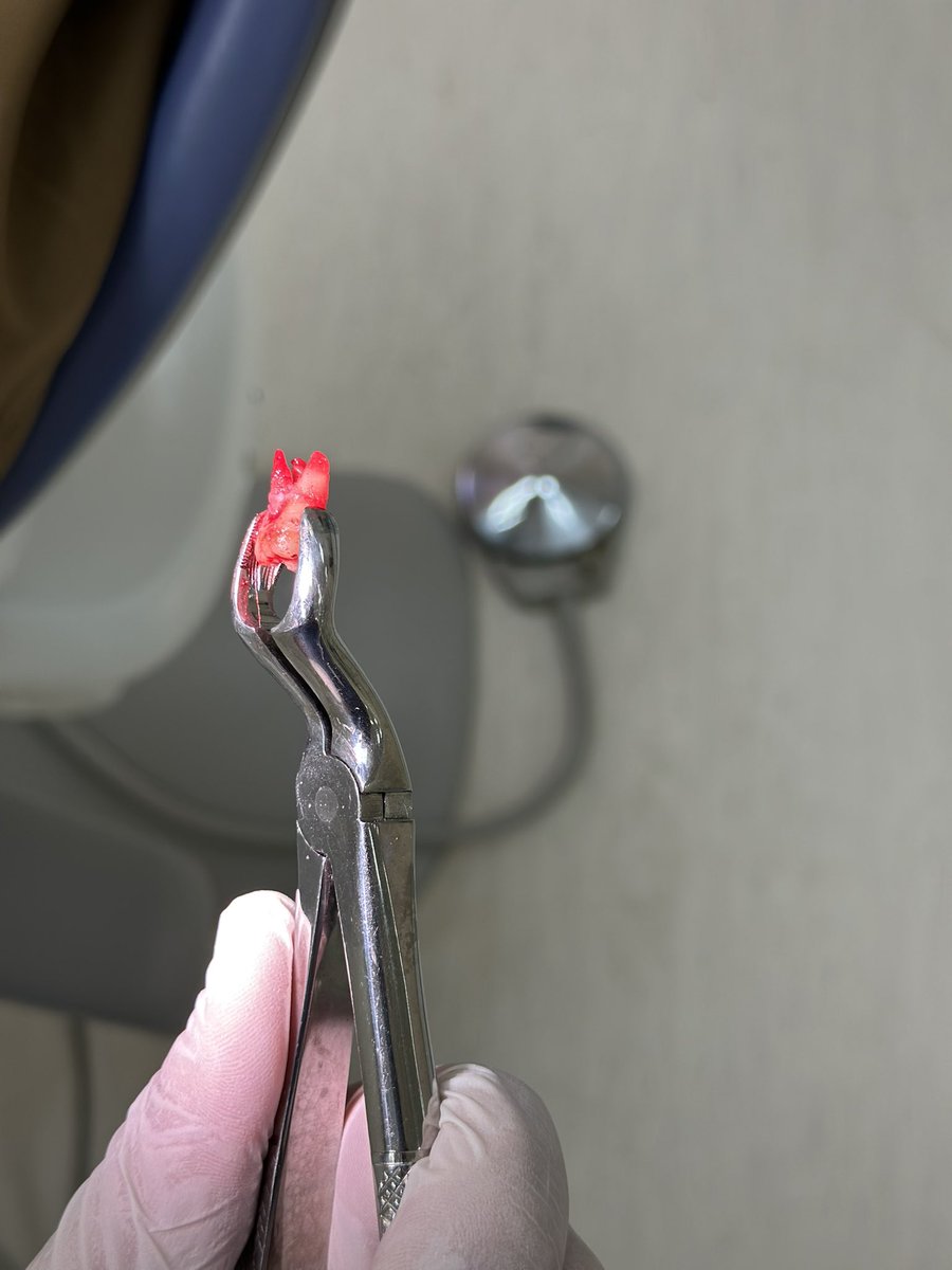 trigeminal_V's tweet image. Always watch the grip 🤝🏻