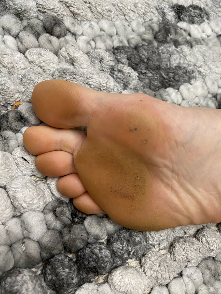 tortureprinces's tweet photo. Dirty feet prepared for clean 
$DIRTY $FEET https://t.co/OpYvdrbd1q