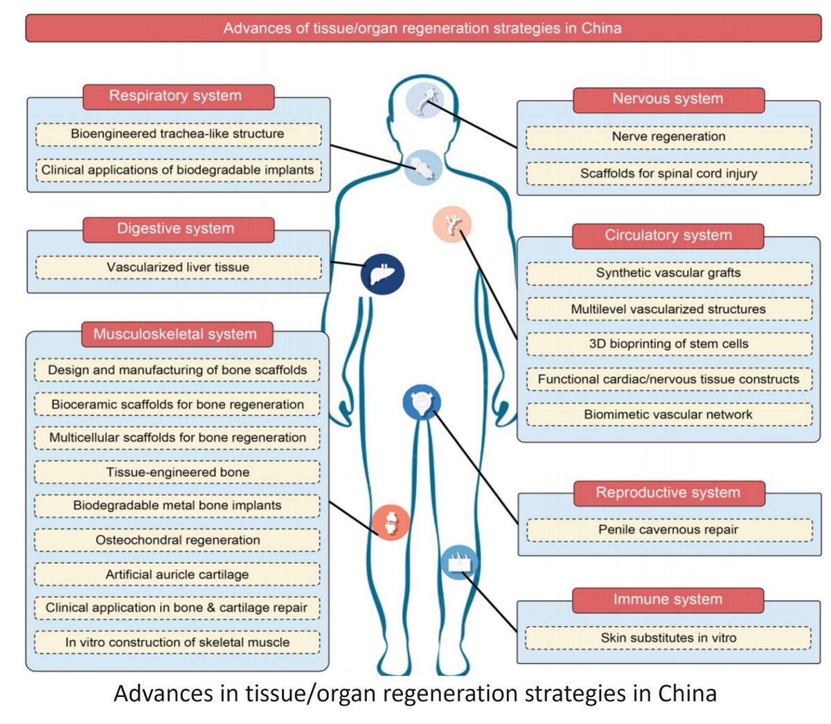 Bio-Design and Manufacturing (@biodesignmanuf) on Twitter photo Chinese Scientists Lead 74-Page Review: 3D Bioprinting Reconstructs Regeneration Medicine in China
Learn more: doi.org/10.1631/bdm.24…
<a href="/ZJU_China/">Zhejiang University</a> <a href="/CAS__Science/">Chinese Academy of Sciences</a> <a href="/Tsinghua_Uni/">Tsinghua University</a> <a href="/NBUniversity/">Ningbo University</a> <a href="/CentralSouth_U/">Central South University</a> <a href="/SCUT1918/">South China University of Technology - SCUT</a> <a href="/HongKongPolyU/">The Hong Kong Polytechnic University (PolyU)</a> <a href="/SCUT1918/">South China University of Technology - SCUT</a> <a href="/NPUintl/">Northwestern Polytechnical University</a> Chinese Scientists Lead 74-Page Review: 3D Bioprinting Reconstructs Regeneration Medicine in China
Learn more: doi.org/10.1631/bdm.24…
<a href="/ZJU_China/">Zhejiang University</a> <a href="/CAS__Science/">Chinese Academy of Sciences</a> <a href="/Tsinghua_Uni/">Tsinghua University</a> <a href="/NBUniversity/">Ningbo University</a> <a href="/CentralSouth_U/">Central South University</a> <a href="/SCUT1918/">South China University of Technology - SCUT</a> <a href="/HongKongPolyU/">The Hong Kong Polytechnic University (PolyU)</a> <a href="/SCUT1918/">South China University of Technology - SCUT</a> <a href="/NPUintl/">Northwestern Polytechnical University</a>